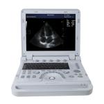 CONTEC CMS1700b Doppler Medical Echocardiography Ultrasound Machine
