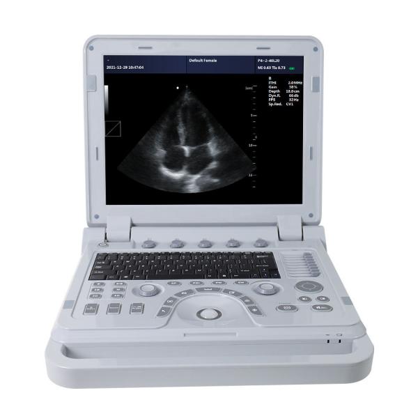 CONTEC CMS1700b Doppler Medical Echocardiography Ultrasound Machine