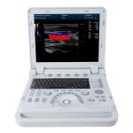 CONTEC CMS1700b Doppler Medical Echocardiography Ultrasound Machine