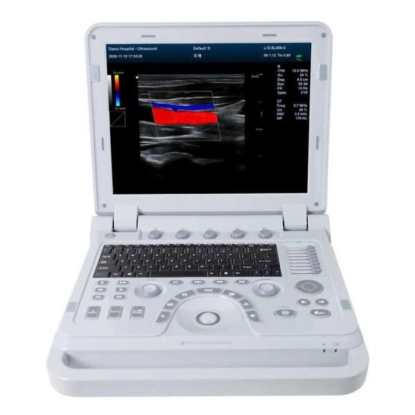 CONTEC CMS1700b Doppler Medical Echocardiography Ultrasound Machine