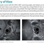 Sonoscape EUS 360" Radial Echoendoscope Endoscopic Ultrasound Usg 4d Sonoscape