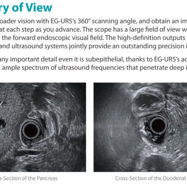 Sonoscape EUS 360" Radial Echoendoscope Endoscopic Ultrasound Usg 4d Sonoscape