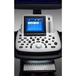 SonoScape S22 Color Doppler Trolley System,NEW VERSION SonoScape S22,HOT SALE SonoScape S22