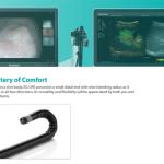 Sonoscape EUS 360" Radial Echoendoscope Endoscopic Ultrasound Usg 4d Sonoscape
